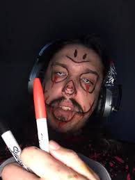 Help.... is it because its winter in the UK and the leaves fall??? Or do I  have a bigger problem ?????