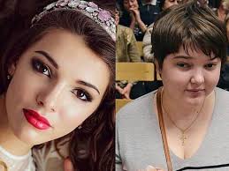 Sevgilisi onu kor və huşsuz etdi FOTOLAR