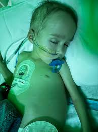 Thank you to the donor from the last 24 hours! Cameron is getting your  cells now! Cameron's intestines have not started up yet since the colostomy  surgery so he has been vomiting