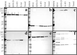 Don't miss the first one about ptms. A Human Protein Atlas For Normal And Cancer Tissues Based On Antibody Proteomics Sciencedirect