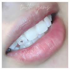 With a wide range to choose from, you definitely will find the best tooth gems at a low price to suit when shopping for tooth gems online, keep a lookout for ongoing promotions to get the most value out of your purchase. Teeth Whitening And Tooth Gem Training Beauty With Britly