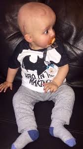 Key points about a brain tumor in a child. Your Baby S Eyes Are Freaking Me Out How Mum Found Out Her Young Son Had A Brain Tumour Mirror Online