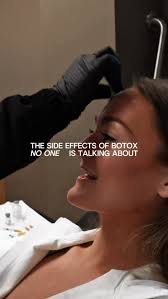 Side effects of Botox NO ONE talks about!, Which one surprised you the  MOST??
