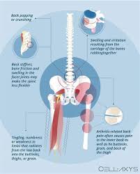 The basic idea of backbone is to organize your interface into logical views, backed by models, each of which can be updated independently when the model changes, without having to redraw the page. Diagram Of Common Back Bone Break Diagram Of Common Back Bone Break Vertebral Column At All Of The Modules Must Be Written In Coffeescript Kop Caneng