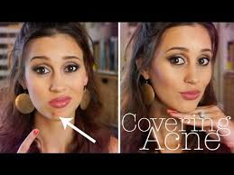 How can i get rid of the blotches on my face? How To Cover A Pimple Flawlessly Youtube