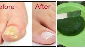 Egzersiz Panosundaki Pin