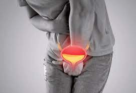 UTI (urinary tract infection):Causes, Symptoms & Treatment - Cura4U