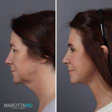 MAROTTA PLASTIC SURGERY SPECIALISTS