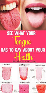 How to clean white tongue naturally. Tips For Nail And Tongue Health Health Care In 2021 Tongue Health Healthy Tongue Tongue Color Health