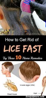 How To Get Rid Of Lice Fast 10 Best Home Remedies Zerofatfitness