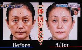たるみ くすみの原因は頭皮にある 30歳から美しく生きるヒント フェイスマッサージ 顔のエクササイズ フェイスケア
