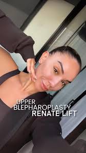 Emma’s Renate lift & upper blepharoplasty journey ✨, For detailed  information;, ☎ +90 538 659 60 00, 📧 info@renateclinic.com, 📍Istanbul