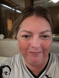 I took your advice and went to a doctor. Mainly cause the pain was so bad  last night I didn't sleep until 6am and it's just your run of the mill  kidney