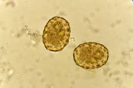 Master herbalist blended for true maximum results. Ascariasis Causes Symptoms And Treatment