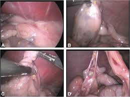A Laparoscopic Approach For Removal Of Ovarian Remnant Tissue In 32 Dogs Bmc Veterinary Research Full Text