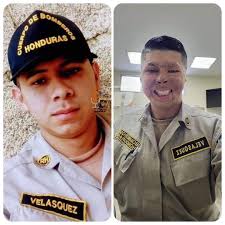 Héroes entre nosotros. ¡El antes y el después de Ángel Velasquez, el  heroico bombero que estuvo a punto de morir en un incendio forestal! Ángel  Miguel Velasquez, es un joven que forma