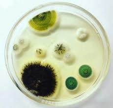 Yamada) nehira aspergillus flavus var. Microbiology Notes And Updates Aspergillus Niger Aspergillus Flavus Aspergillus Fumigatus Rhizopus Stolonifer And Penicillium Spp On Sabouraud Dextrose Agar Sda Facebook