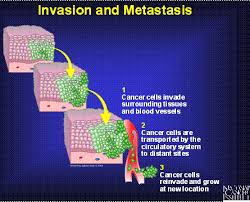 Their characteristics are very different from those of normal cells. Biology Exams 4 U Characteristics Of Cancer Cells How Cancer Cells Are Different From Normal Cells
