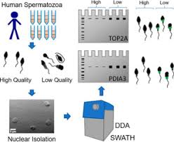 German bbw pawg samantha masturbating in black stockings. Proteomic Analysis Reveals That Topoisomerase 2a Is Associated With Defective Sperm Head Morphology Molecular Cellular Proteomics