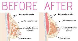 You see, vaseline is made of petroleum jelly, and it has some other chemicals as well in tiny amounts as well. Can I Enlarge My Breast While I Am A Guy Quora