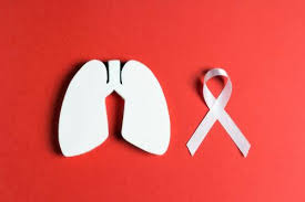 Together we will beat cancer total raised £0.00 + £0.00 gift aid donating through this page is simple, fast and totally secure. Can Asbestos Lung Cancer Be Cured Lung Cancer Lawsuit Lawyers Pintas Mullins Law Firm