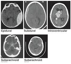 Image result for CT Head