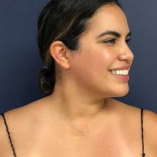 Sono Bello Cost & Pricing Options