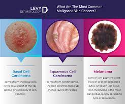 skin cancer is one of australia&#x27;s most common cancers, with data showing almost a million cases of skin cancer in 2015. Home Remedies For Skin Cancer Latest Breaking News India News Political Sports Since Independence