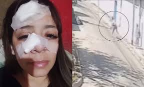 Le fracturaron la nariz porque no les dio comida: "Me pidieron de mala  manera y me tiraron piedras"