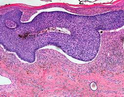 The animals were 8 to 20 years old (median age: Unknown Two Adjacent Nodules On The Leg