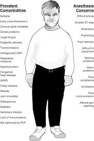 We did not find results for: Anesthetic Management Of Elderly Patients With Down Syndrome A Case Report Journal Of Perianesthesia Nursing
