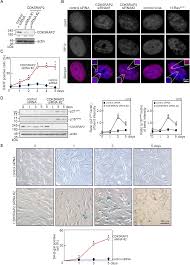 CDK5RAP2 loss-of-function causes premature cell senescence via the  GSK3β/β-catenin-WIP1 pathway | Cell Death & Disease