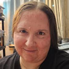 Why haven't some people received their call-up numbers for NYSC batch A1?