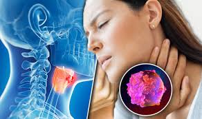 A plain old sore throat or a cough usually aren't big deals. Cancer Symptoms Throat Tumour Signs Include Sore Throat Express Co Uk
