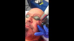 Tear tattoo is a common prison tattoo. Teardrop Tattoo Removal A Life Changing Procedure Youtube