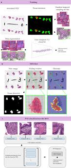 We must also consider how many people will become infertile (both men and women, and no, there isn't any other gender). Deep Learning Models For Histopathological Classification Of Gastric And Colonic Epithelial Tumours Scientific Reports