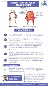 Image result for paraphimosis