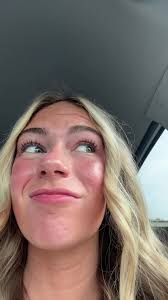 Marchetti Towers Slu