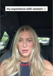 Veneer Before After Girl