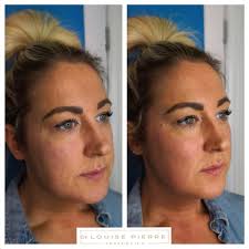 Dr. Louise Pierre Aesthetics
