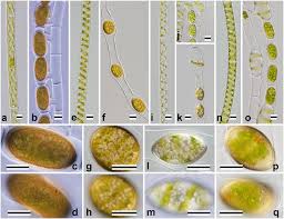 Spirogyra genus dari ganggang hijau dari ordo zygnematales. Nomarski Interference Micrographs Of Four Species Of Spirogyra Download Scientific Diagram