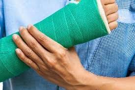 Basparmak Kok Ekleminde Kireclenme Osteoartrit Nedir Op Dr Haldun Seyhan