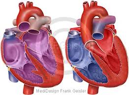 519 likes · 9 talking about this · 273 were here. Fehlbildung Herz Angeborene Herzfehler