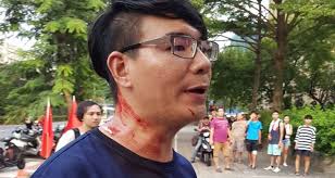 這種人不就跟丐幫哲學一樣 無賴寄生蟲流 明明bnt可以早來 為瓶身那復必泰去爭不是原廠 明明疫苗不夠說夠. å°ç¨æ©Ÿé—œæ§æŽæŸç'‹ é¢¨å‚³åª'