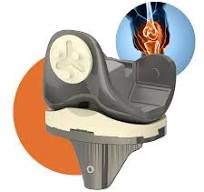 Products - Optimotion