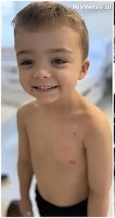 To Chance a very courageous boy!, #Chancethenapper