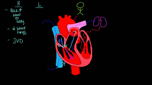 Left Sided Vs Right Sided Heart Failure Right Sided Heart Failure Left Sided Heart Failure Heart Failure