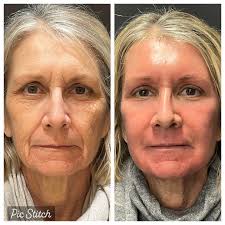 Docteur Bruno Ripault