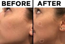 Shop niacinamide 10% + zinc 1% by the ordinary at cult beauty. We Tried The Ordinary Skincare Line The Internet Is Talking About And Here S How It Went