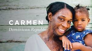 How Surviving Burns at Five Months Pregnant Set Carmen Free